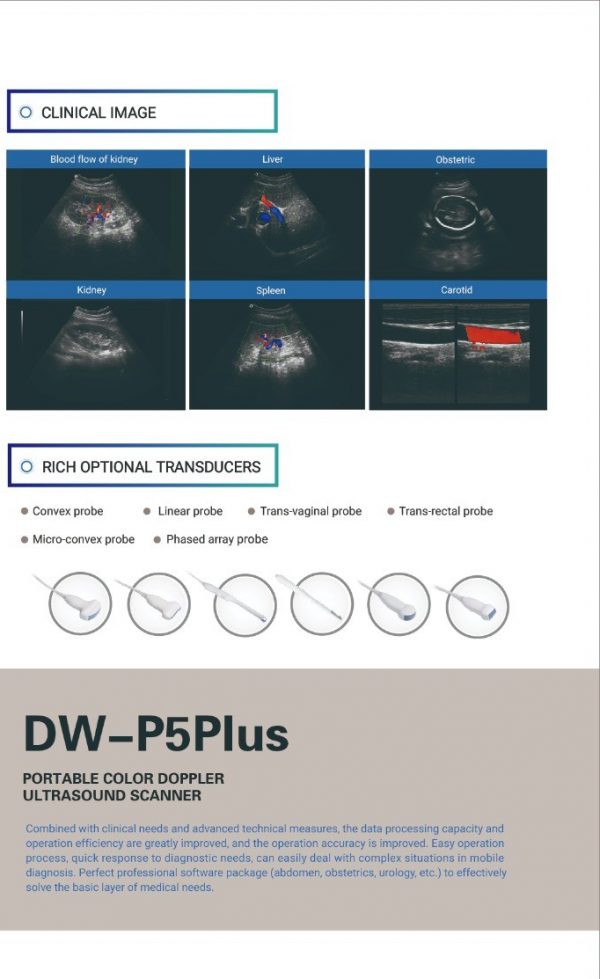 DW-P5PLUS PORTABLE COLOR DOPPLER ULTRASOUND SCANNER